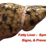 fatty-liver