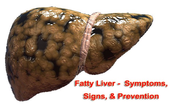 fatty-liver